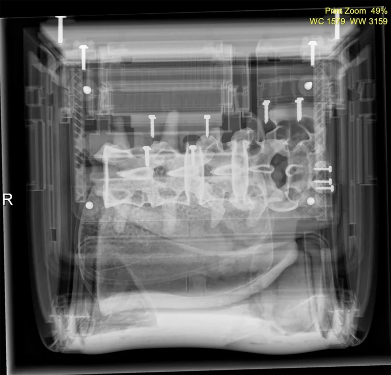 Lateral X ray view during training on the Lumbar Posterior Lateral