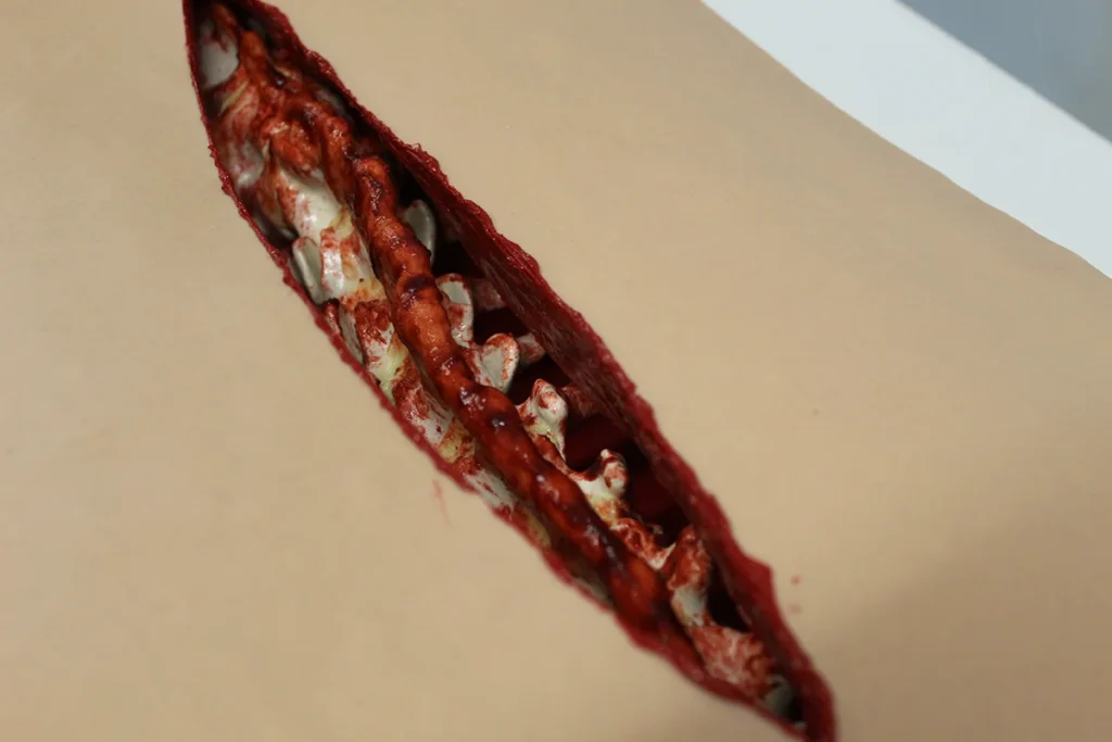 Posterior instrumentation on the RealSpine Deformity model